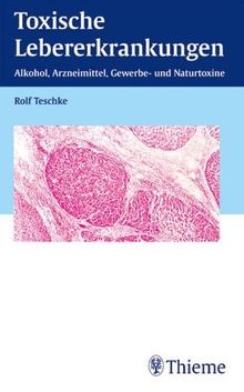 Toxische lebererkrankungen - toxische,